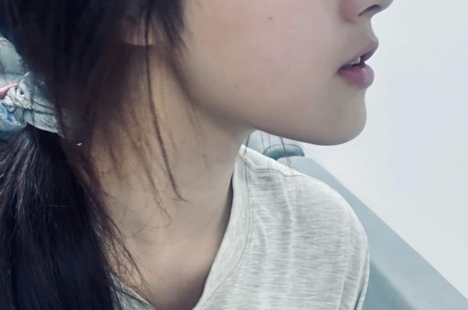 张含韵 - 今日头条